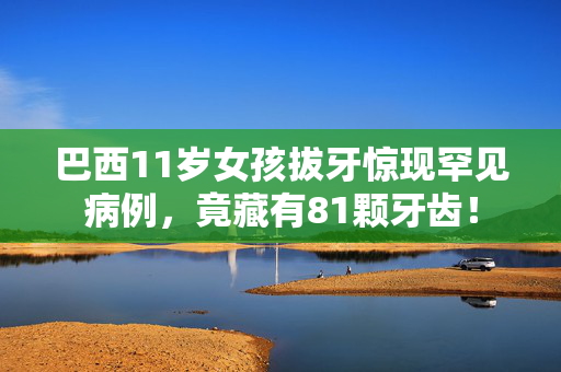巴西11岁女孩拔牙惊现罕见病例，竟藏有81颗牙齿！